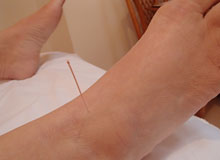 Susan Thorne Acupuncture Tanglewood Clinic